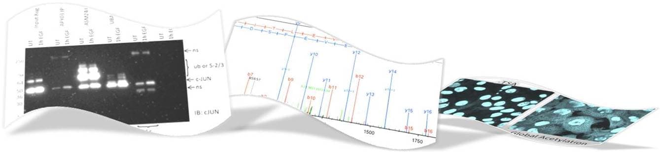 Post-Translational Modification Detection Techniques