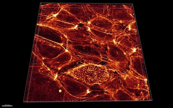 HUVEC Cells