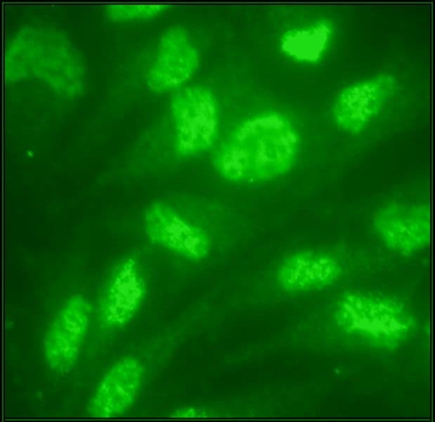 Immunofluorescence AUB01