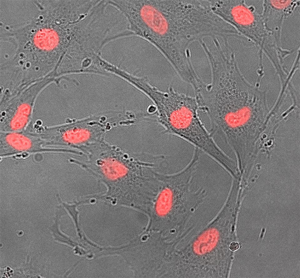 microscopy of cells with nuclear staining