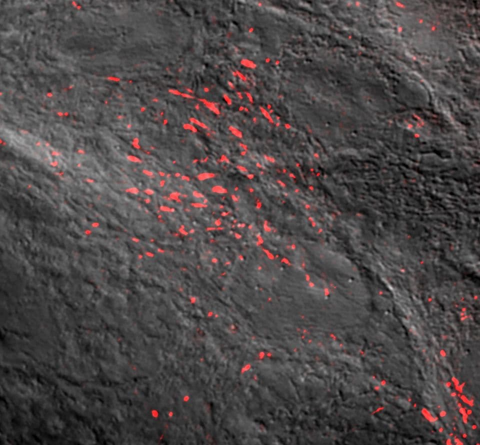 microscopy of fluorescent fibronectin treated cells