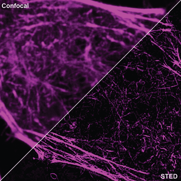 Cytoskeleton Image
