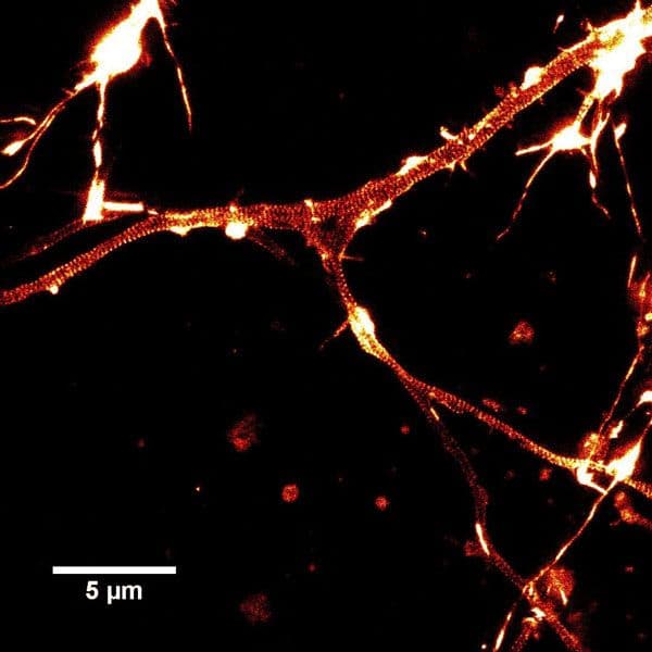 Rat hippocampal neurons