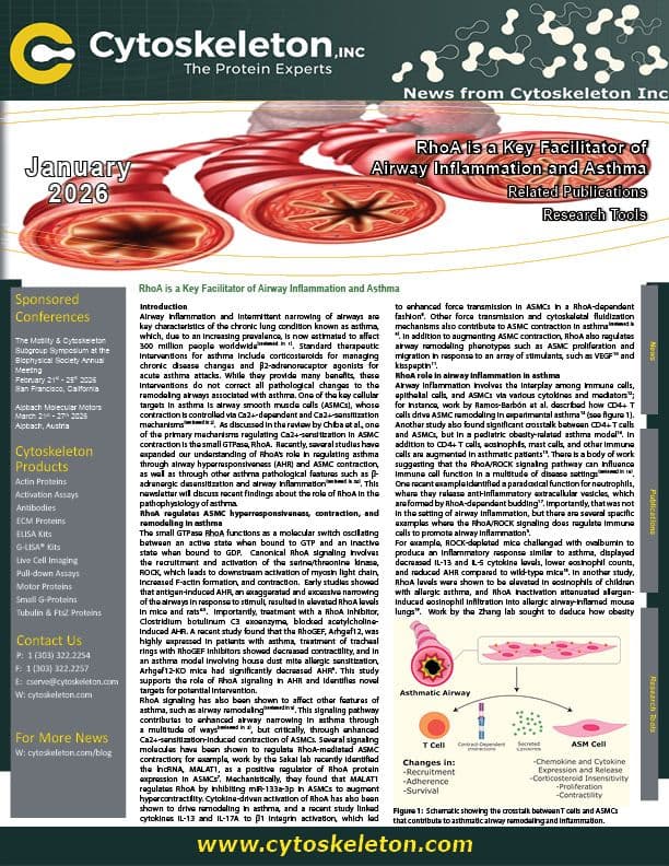 RhoA is a Key Facilitator of Airway Inflammation and Asthma