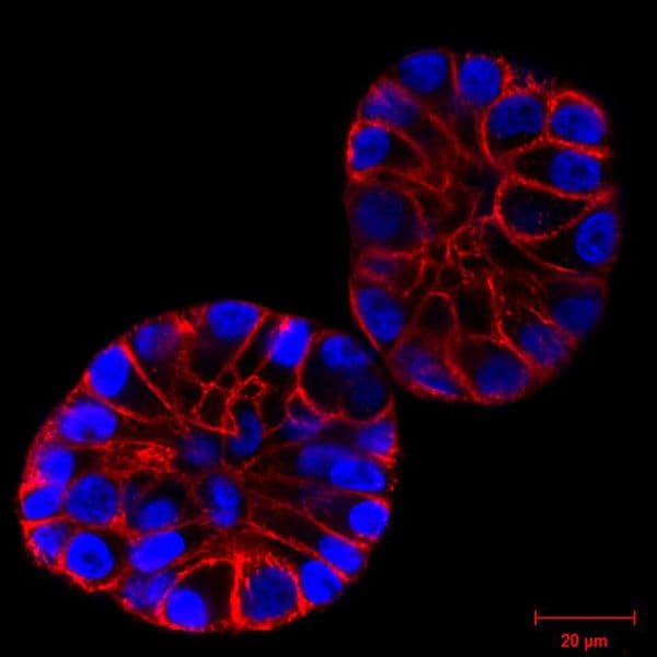 MCF10A Cells (3D culture)