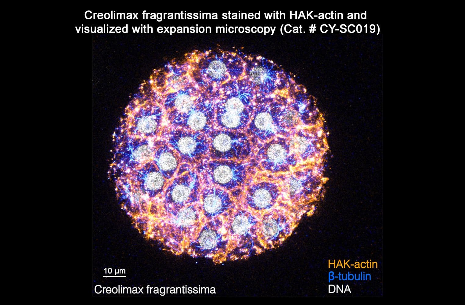 Creolimax fragrantissima stained with HAK-actin