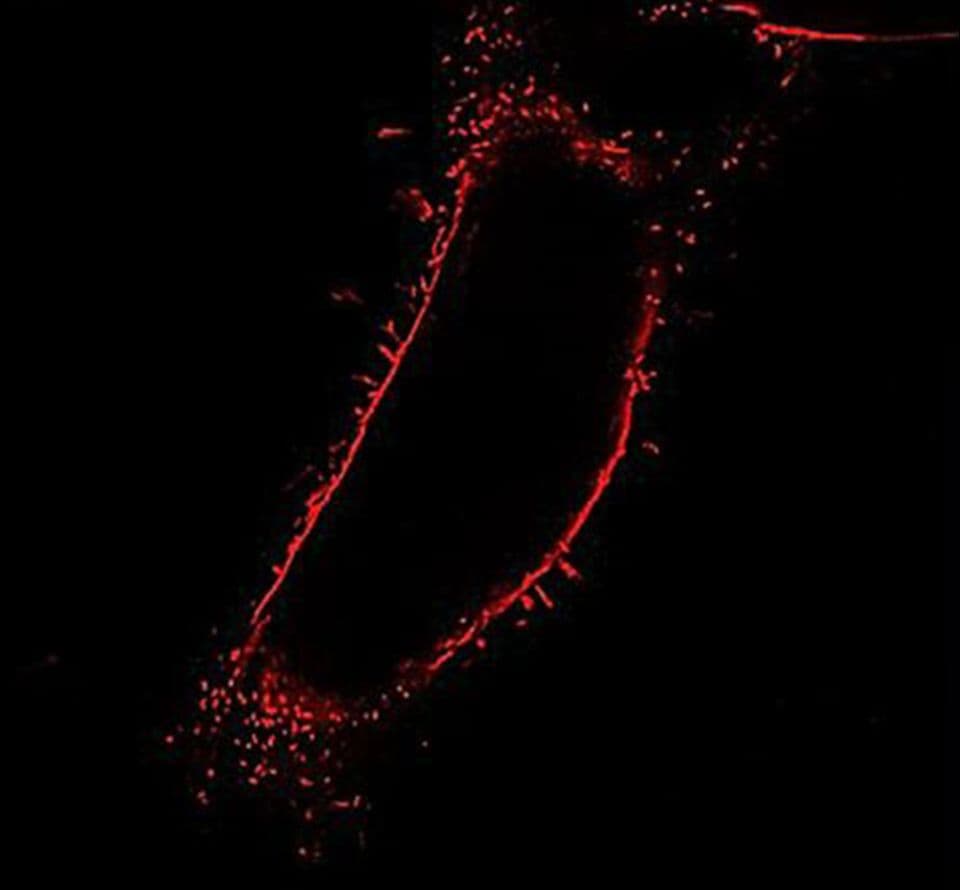 fluorescence microscopy of a cell labeled with membrane polarity probes