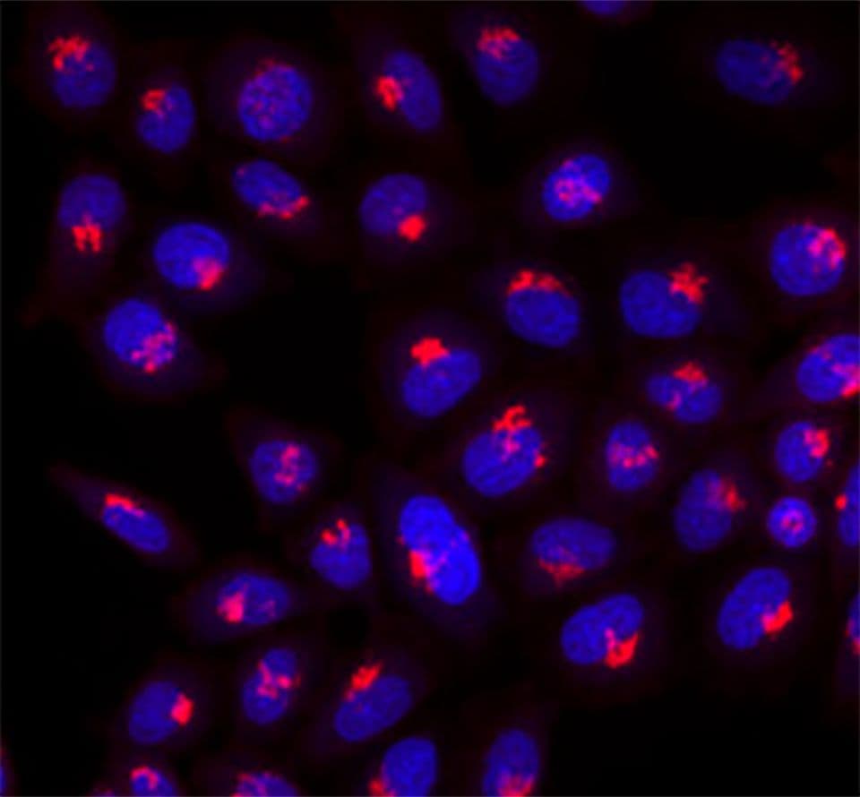 microscopy of cells labeled with Golgi markers