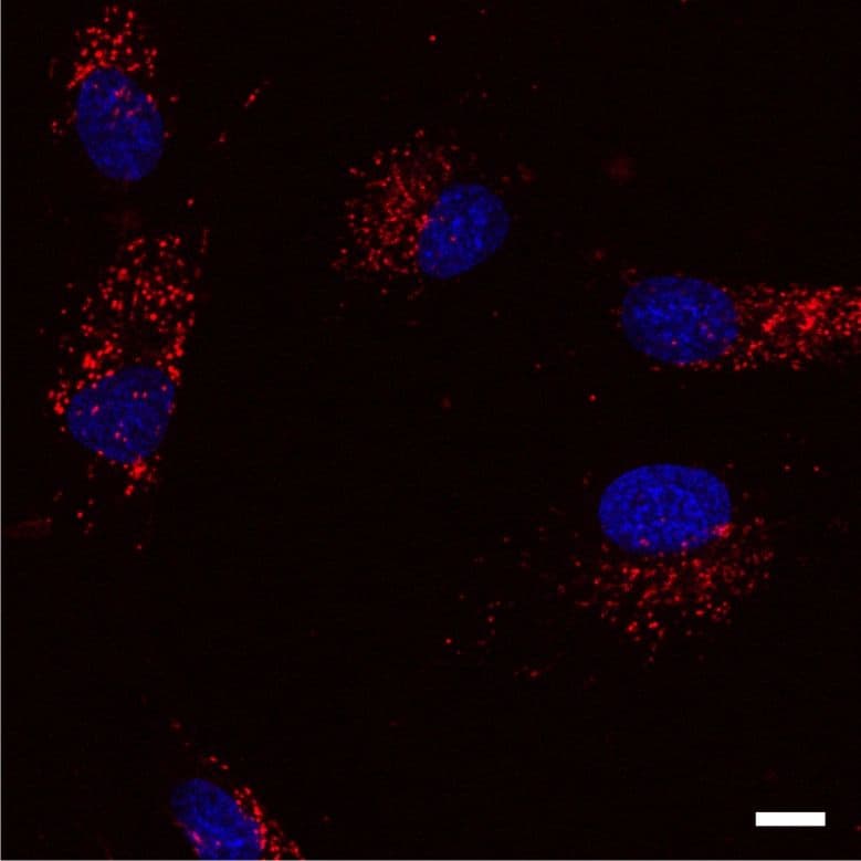 Image endosomes and lysosomes during cell motility