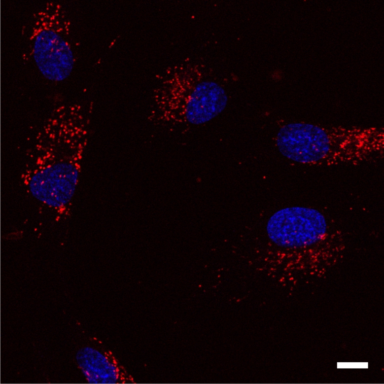 Fibroblasts_SiR-lysosome_Hoechst_Confocal